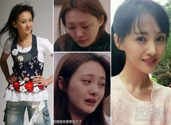 《旋风孝子》郑爽又美回来了 郑爽爸爸一夜爆红 郑爽整容前后对比