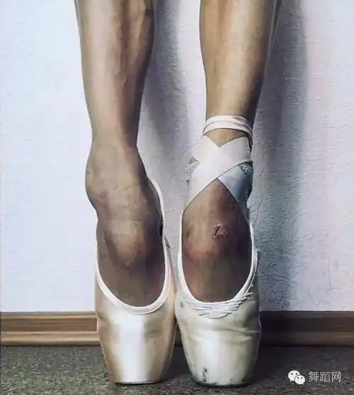 【慎入】专业芭蕾舞者的脚