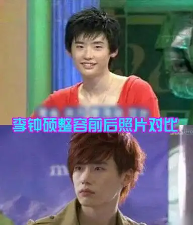 李钟硕承认整容前后照片对比 李钟硕整容前后对比照曝光