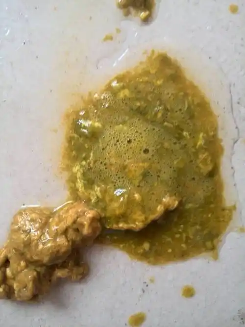 问:请问拉的这样大便,是怎么回事啊?七个半月的宝宝