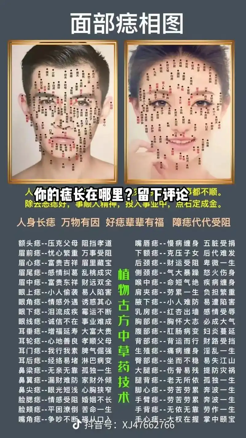 脸上痣多的女生好看吗图解 - 抖音