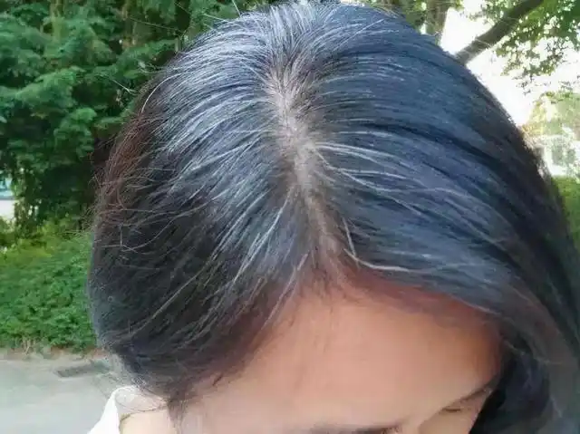 你以为是老了,医生:或是缺乏2种营养素|白发|染发|维生素_网易订阅