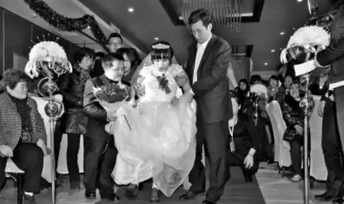 河南"巨腿女孩":拖34斤瘤子生活多年,22岁将其锯下,结婚生子_孙晶晶