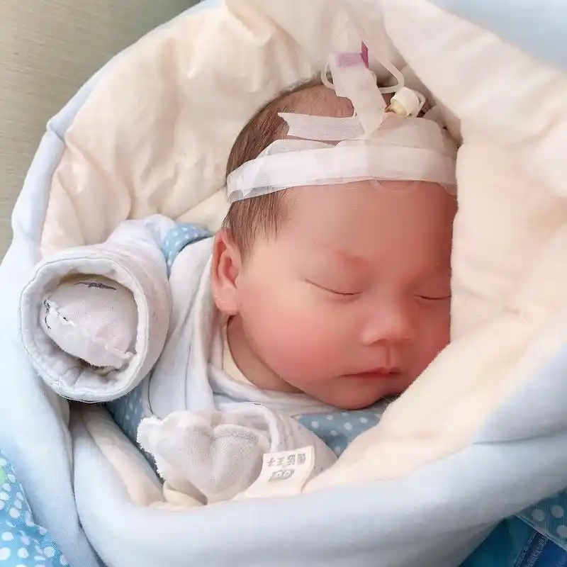 刚出生一个月零6天的宝宝,被传染99了,小小的他要承受那么大 - 抖音
