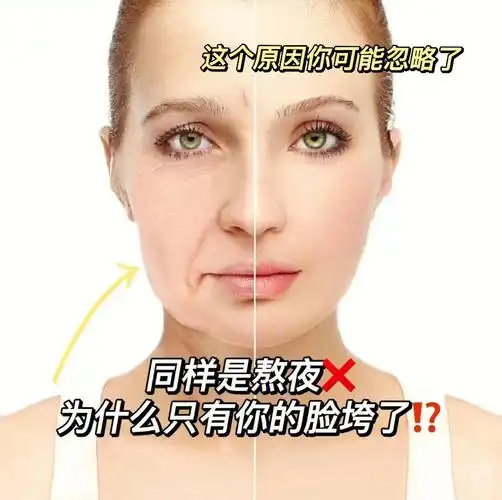 同样是熬夜为什么只有你的脸垮了