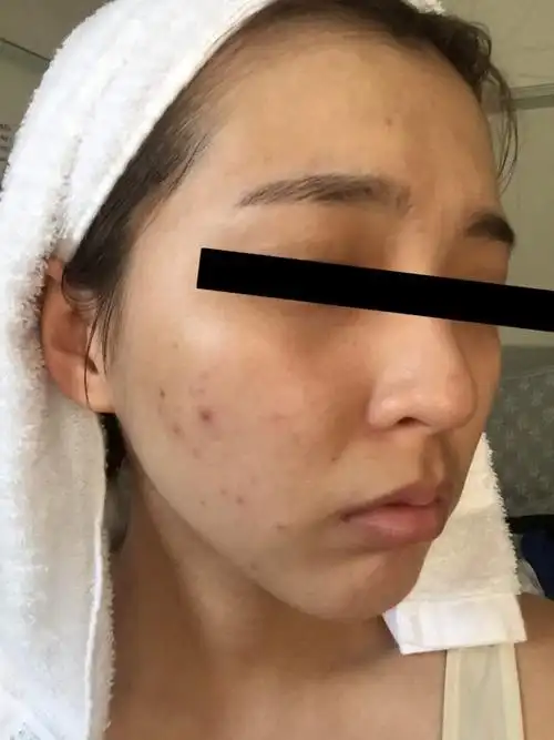 女友最近的皮肤变很差,才知道一分钱一分货再也不敢让他用便宜洗面乳!