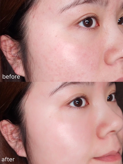 面霜是什么(全套护肤品的正确使用顺序)