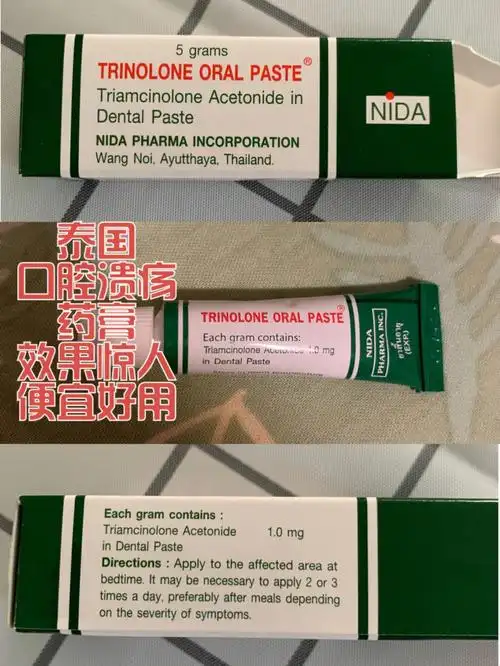 泰国便宜好用的口腔溃疡药膏