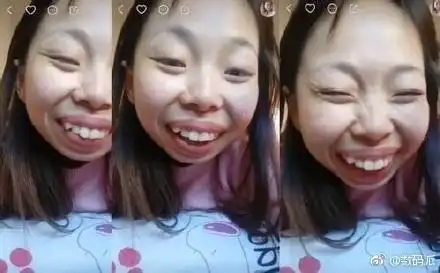 ▼网红一笑露牙毁了!抖音官方吓坏「影响市容」封杀 网赞爆:伤眼.