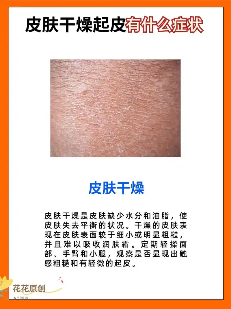 皮肤干燥起皮是什么症状?🆘🆘.#立秋 #告别肌肤问题 # - 抖音