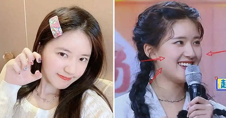 赵露思疑似医美,鼻翼狭窄鼻孔不自然,与黑白片的风格截然不同!