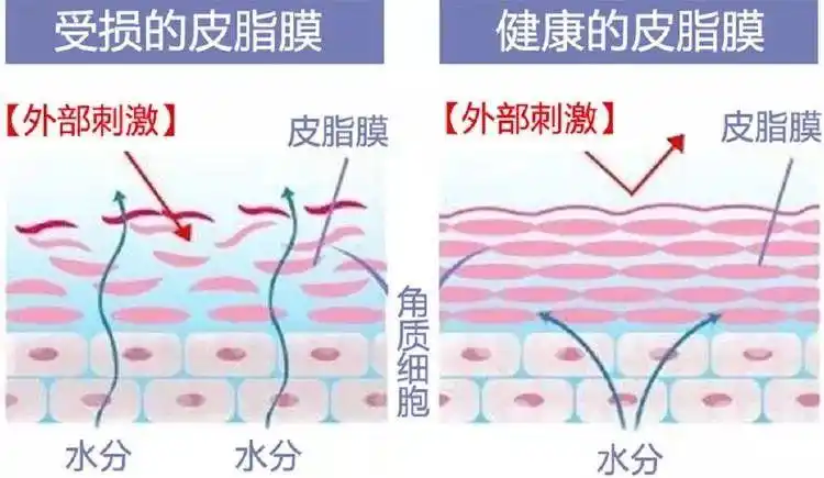 皮肤管理丨走进皮脂膜的世界_肌肤