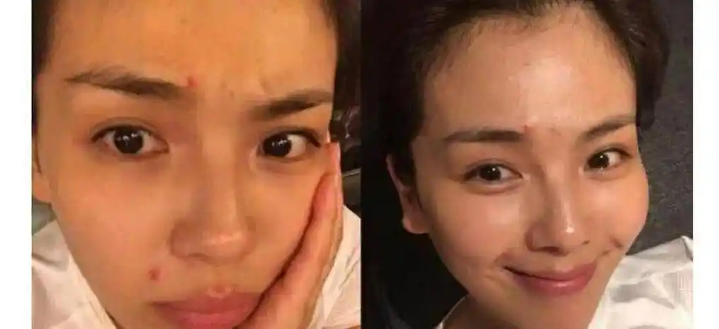 果然明星卸妆后和真人真的差距很大