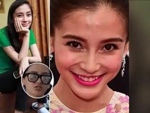 盘点素颜最丑的女明星 赵丽颖李小璐皮肤差