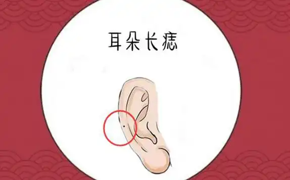 耳朵上有痣代表什么意思耳朵长痣相图解大全