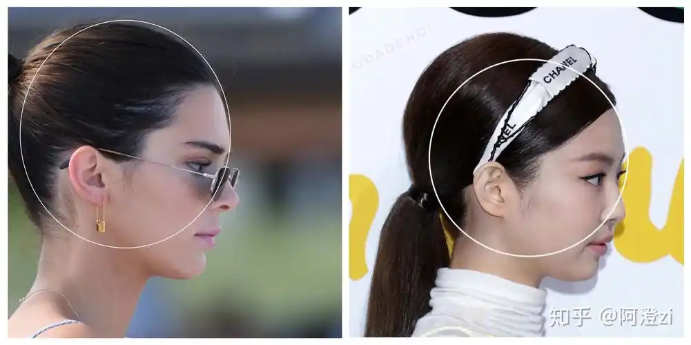 颅相审美颅顶低对颜值到底有什么影响