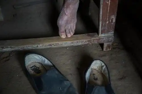 2018"徐肖冰杯"中国纪实摄影展入展作品《我的爷爷奶奶》-刘磊