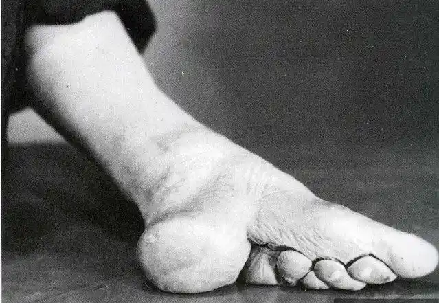 缠足一般从四五岁开始,历经三四年时间,到七八岁时才能初具模样.