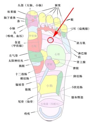 脚底 皮下 有一个东西 怎么办?