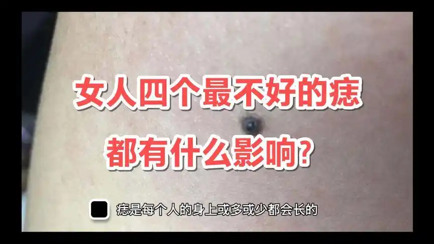 女人四个最不好的痣,都有什么影响?-情感视频-搜狐视频