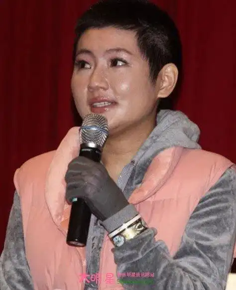 selina任家萱烧伤事件烧伤前后对比照3