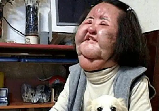 10位整容变毁容的女星有几位曾经美艳动人现在却无颜见人