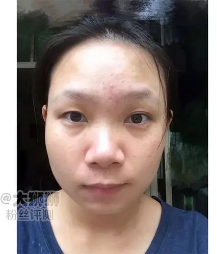 我属于混合性肌肤,脸部t字区爱出油,这几年以来t字区就是油脂分泌非常