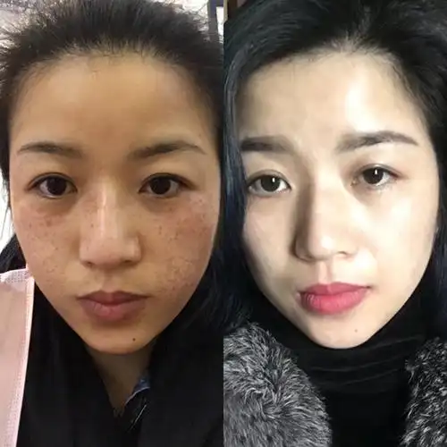 祛斑美白的方法偏方_祛斑美白最好的方法_蜂蜜祛斑方法 天然祛斑又