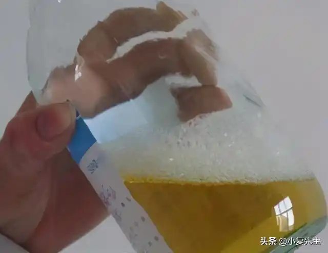 高尿酸的人不论男女:若出现这3种表现,可能肾衰竭要来了