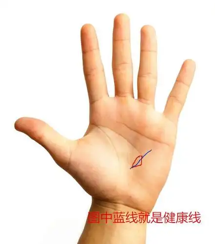 1,生命线岛纹是什么形状图片:生命线起始端出现锁链状的岛纹,说明小的
