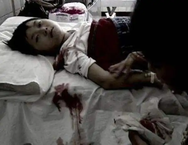 小苏丽验尸照片(死后遭亲生母亲扒坟)