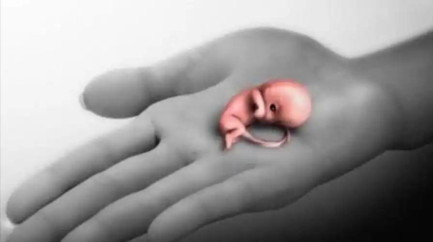 60天的胎儿流产出来的样子,震撼人的内心,实在是不忍心看