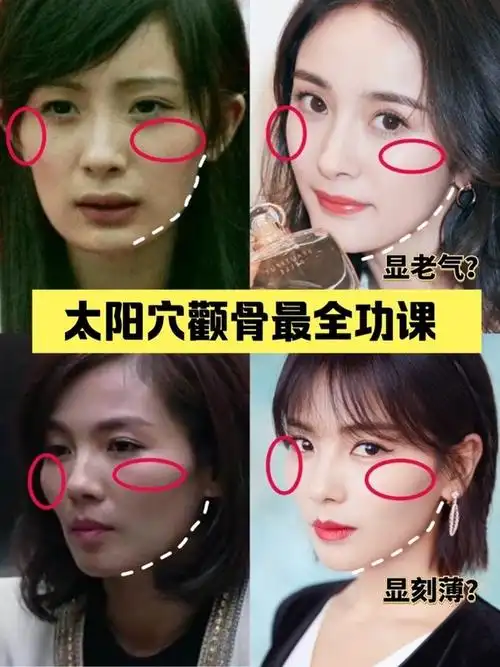 太阳穴凹陷or颧骨高63怎么才能不显老92功课