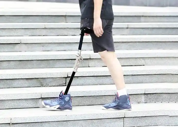 大腿假肢静态对线