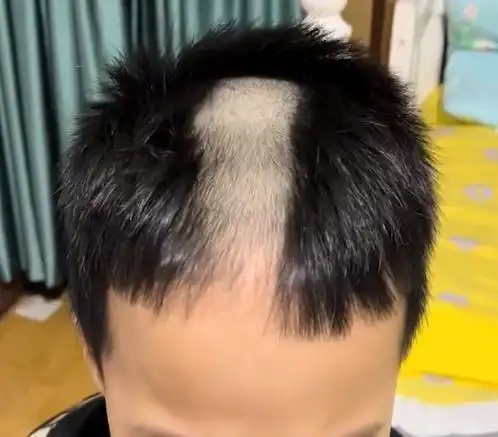 吉林男孩玩推子给自己头发剃了委屈展示的样子让网友忍不住笑了