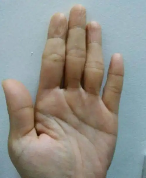 不管男女,此处超长且深厚,注定长寿之命,活到99岁的手相