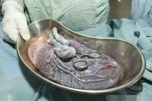 被中国婆婆捧上天的胎盘,背后这些真相,恐怕没你想象那么美好