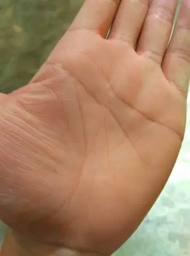 这是我的手相,生命线是不是很短,中间有一点短的是不是不算,那位大师