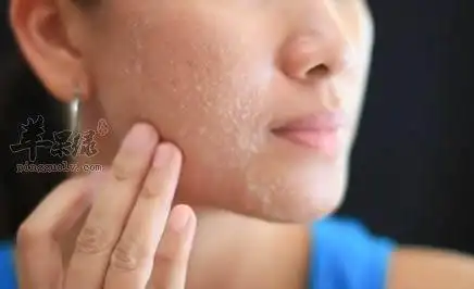 皮肤的角质层变薄了怎么办