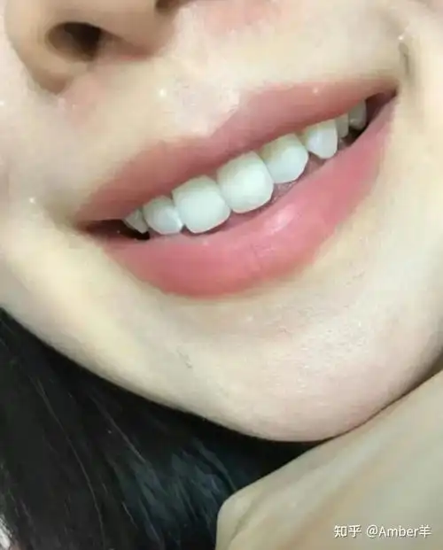 有普通人能效仿的美白牙齿的方法吗?