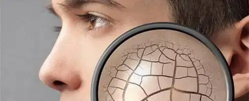 皮肤敏感脆弱怎么办