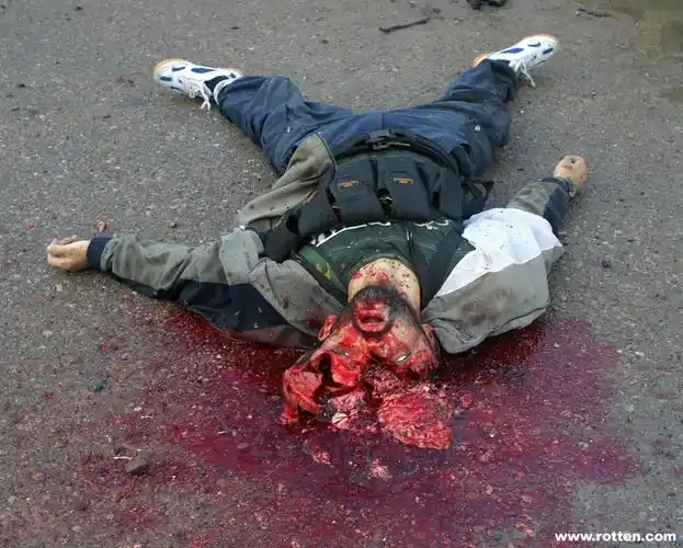 恐怖啊~~看了要吐~~脏~~恶心