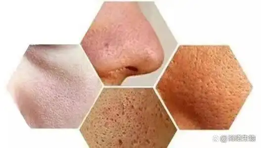 如何判定你是粗糙皮肤