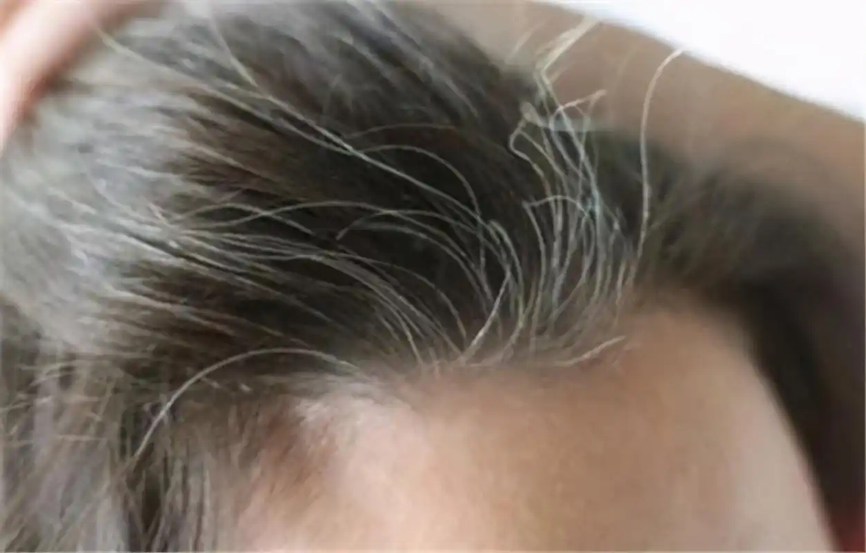 为什么白头发越长越多不要以为自己老了或是缺了这两种营养