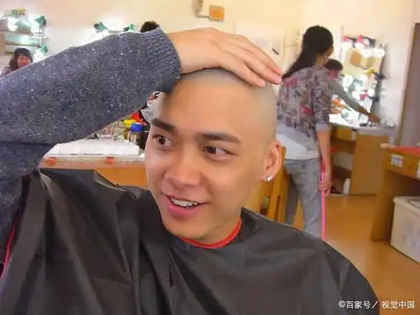 剃了光头还会有头皮屑吗