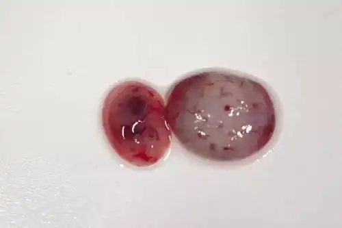 先兆流产需重视,八大护理祝好孕