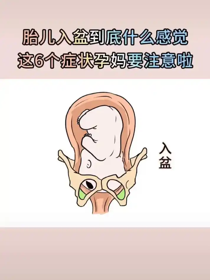 胎儿入盆是什么感觉?有这六个症状要注意啦||| 胎儿入盆一般 - 抖音