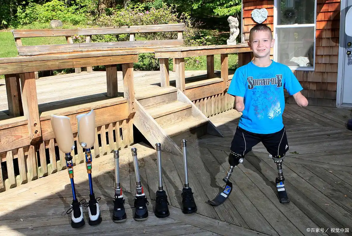 没有四肢的小孩不是重点,假肢以及他开朗乐观的态度才是重点