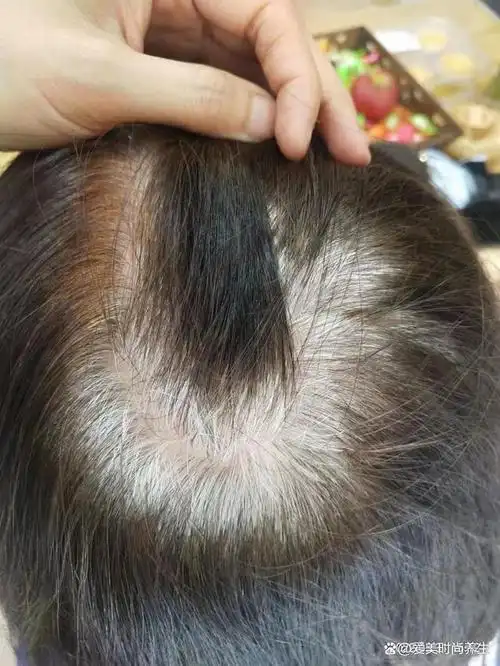 你们有这么多白发时该怎么办