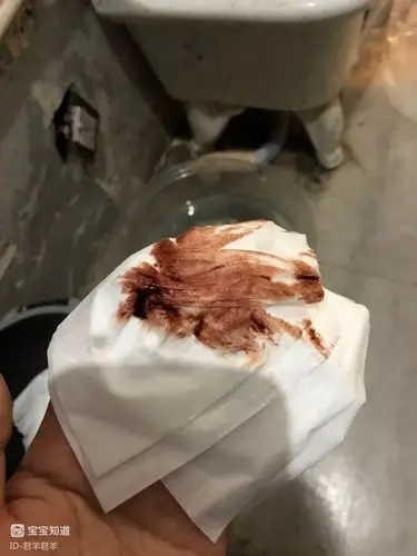 孕五周早上九点多去厕所发现褐色血擦了三四次一直有还挺多马桶里也有